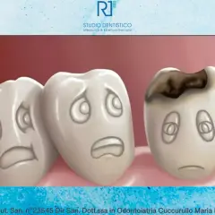 Tre denti con faccine tristi. Uno mostra un dente cariato, con un'espressione di dolore.