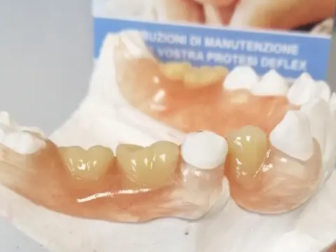Protesi flessibile Deflex: costi, vantaggi e quando conviene