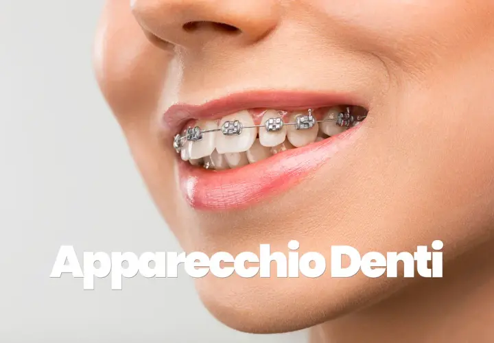 Sorriso con apparecchio denti, per un sorriso perfetto.