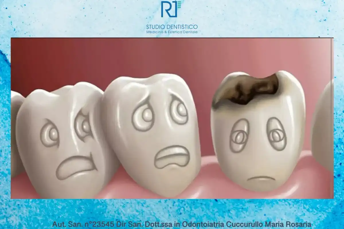 Dente cariato - sintomi, cure e quando andare dal dentista