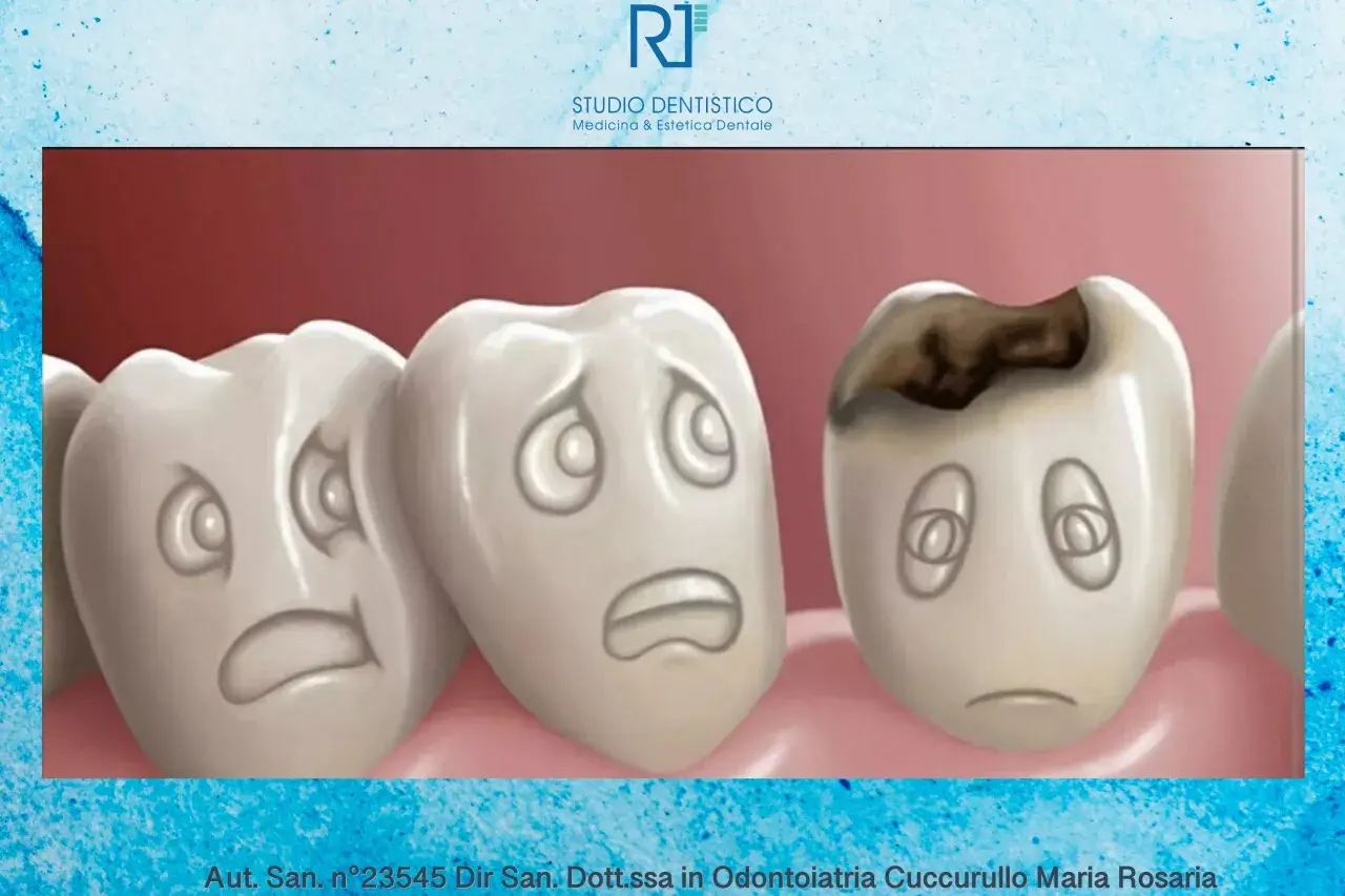 Tre denti con faccine tristi. Uno mostra un dente cariato, con un'espressione di dolore.